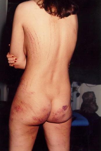 20P Vintage spanking and bruising beating of retro fetish model Ra
