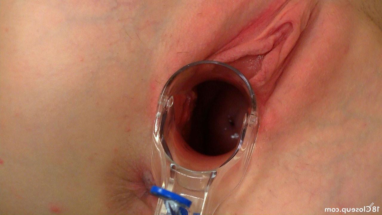 16P Cervix Contractions During Orgasm