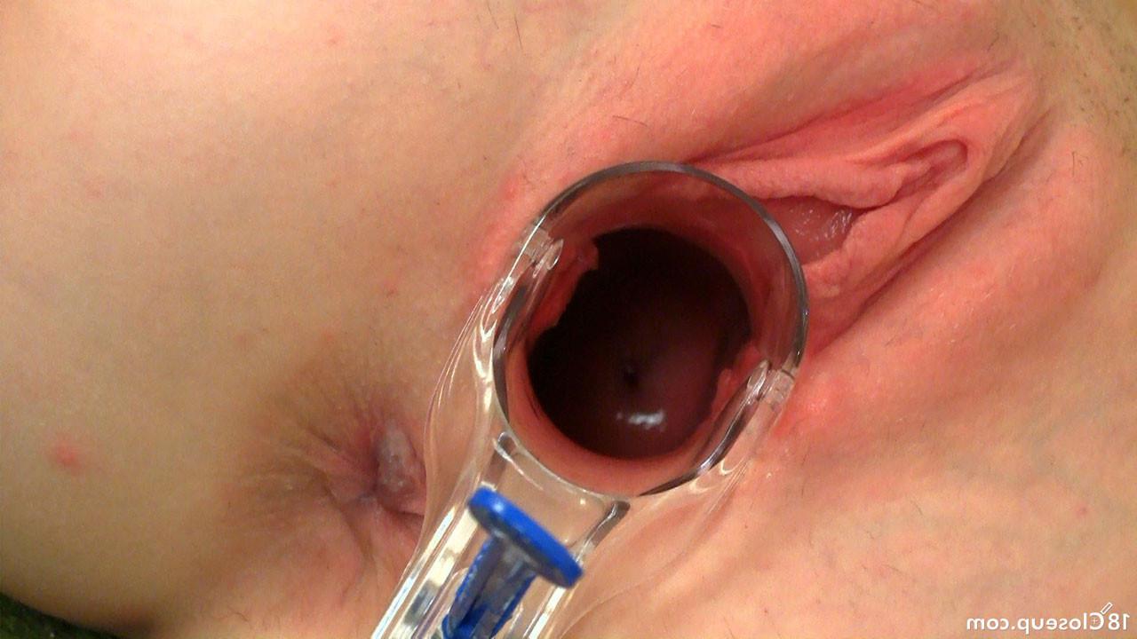 16P Cervix Contractions During Orgasm