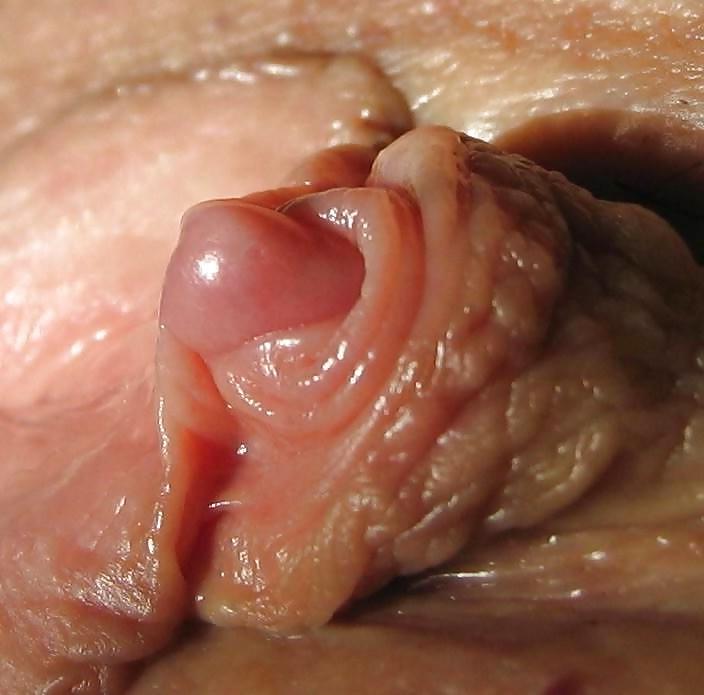 15P abnormal huge swollen meaty clits close ups