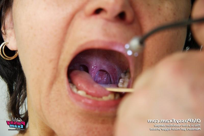 15P Miriam pussy fetish mature gyno examination at kinky clinic