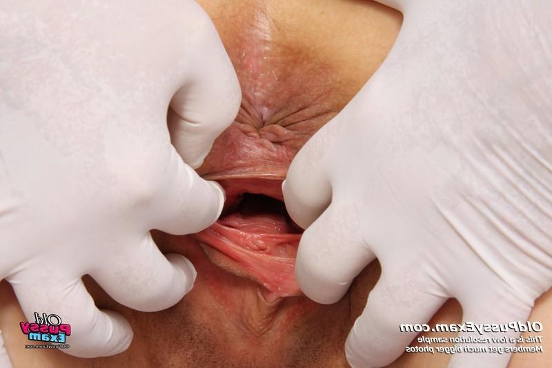 15P Radima visits kinky clinic to have her mature pussy examined