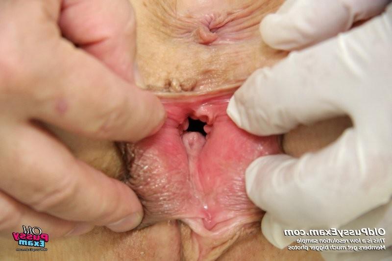 15P Old Mila pussy gyno speculum clinic examination by doctor