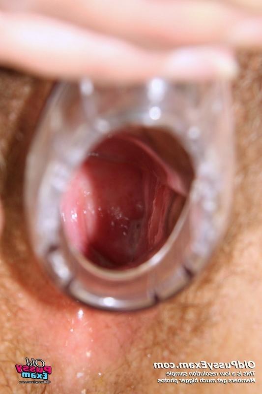 15P Linda mature pussy speculum gyno examination at clinic