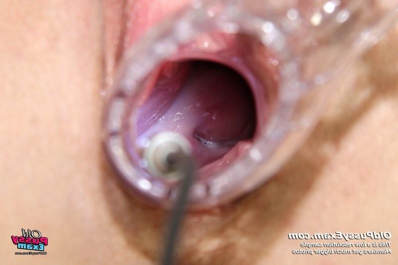 15P Mature Alena gyno pussy real clinic examination