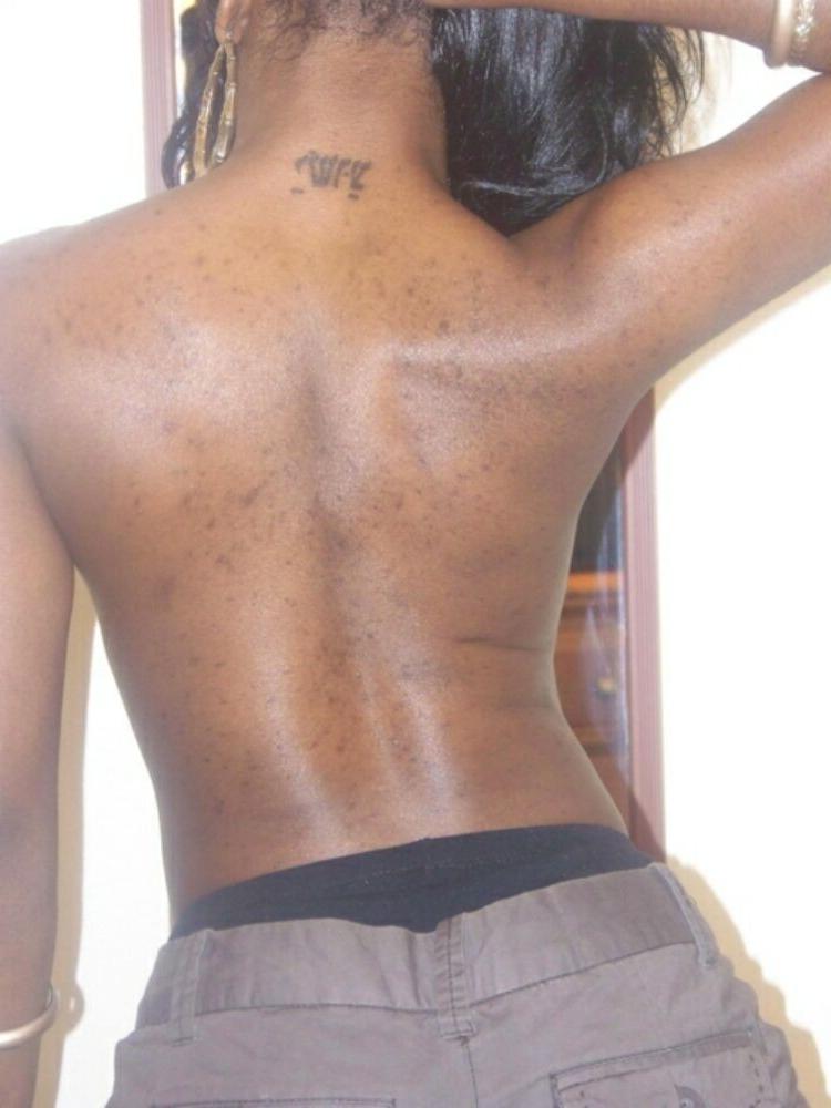 15P Exploited black teens are posing and fucking gallery 2