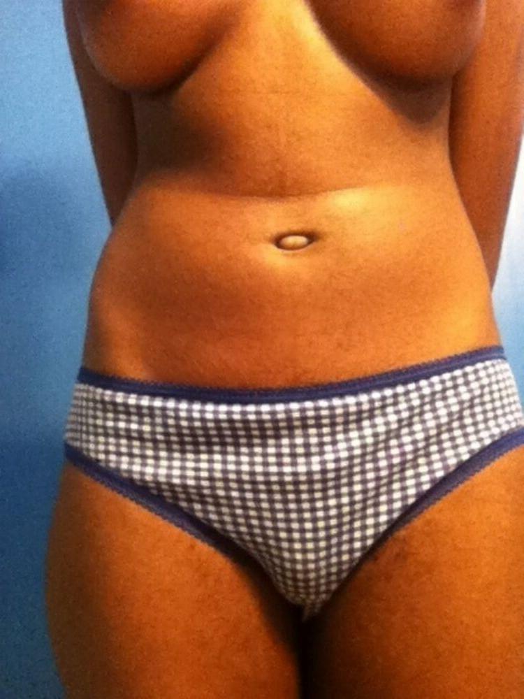 15P Exploited black teens are posing and fucking gallery 17