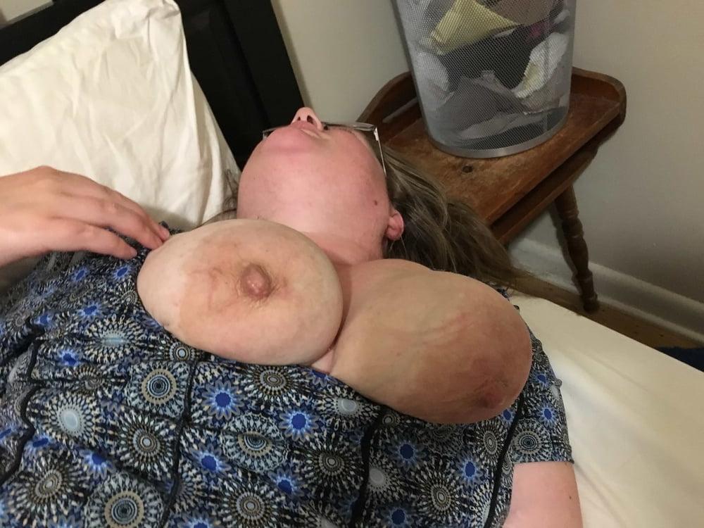 25P Nicely Notable Nipples   81