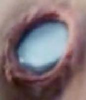 25P Extreme Close up  Pics