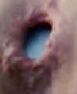 25P Extreme Close up  Pics