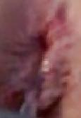 25P Extreme Close up  Pics