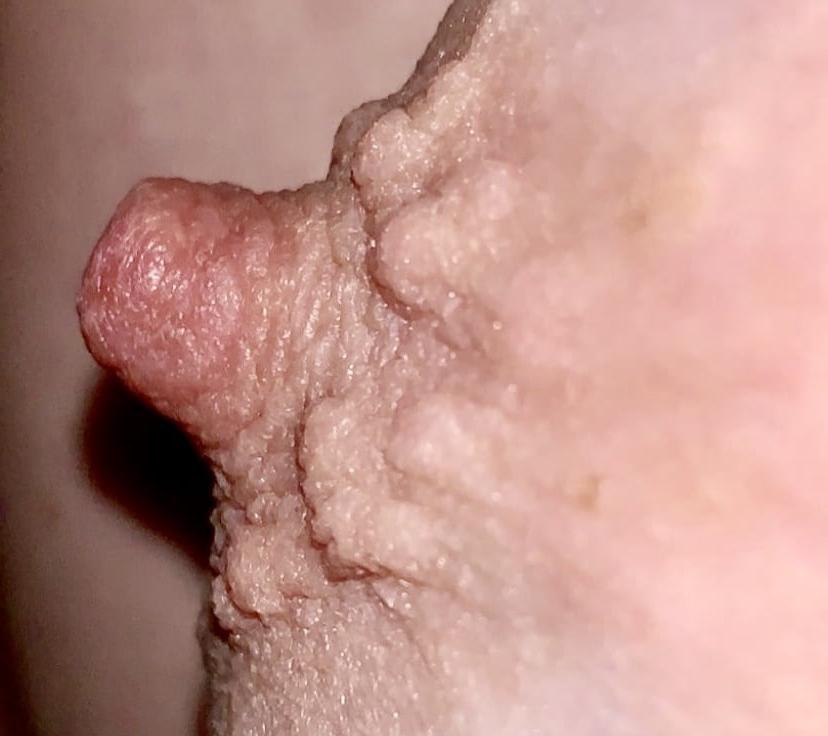 25P Wifes erect nipples