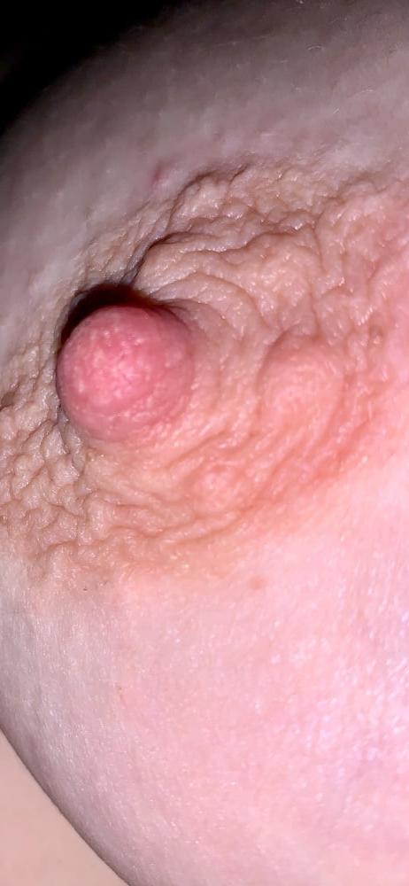 25P Wifes erect nipples