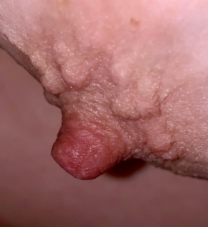 25P Wifes erect nipples