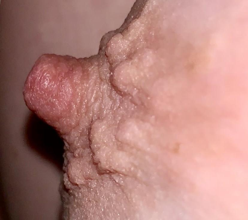 25P Wifes erect nipples