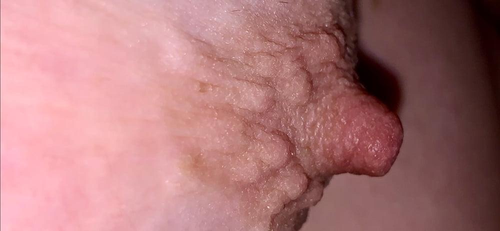 25P Wifes erect nipples