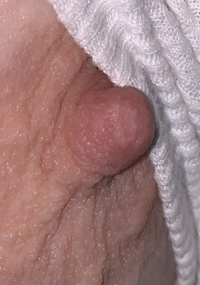 25P Wifes erect nipples