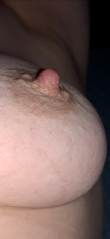 25P Wifes erect nipples