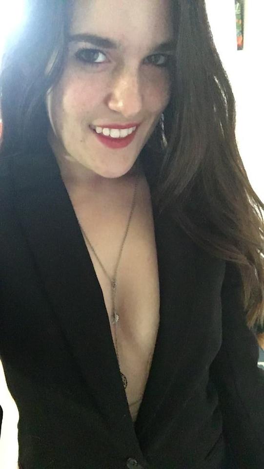 25P DNC operative with puffy Nipples