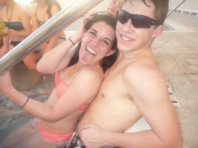 25P DNC operative with puffy Nipples