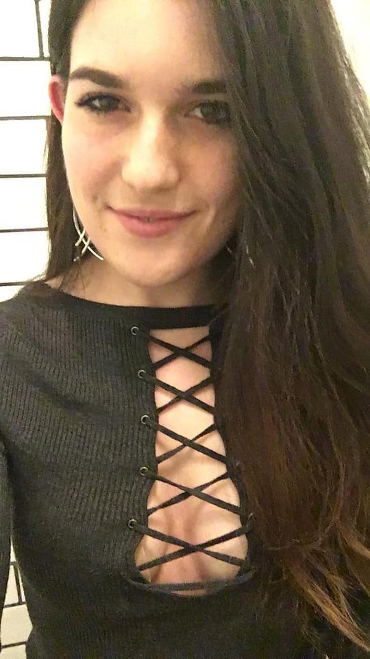 25P DNC operative with puffy Nipples