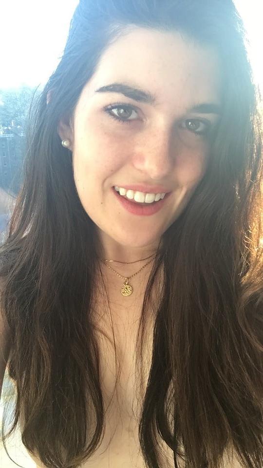 25P DNC operative with puffy Nipples