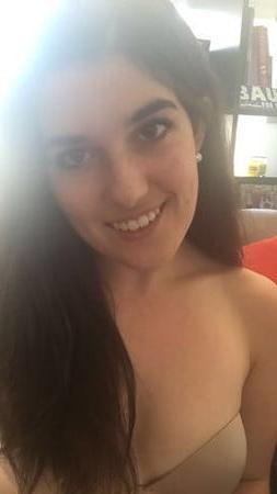 25P DNC operative with puffy Nipples