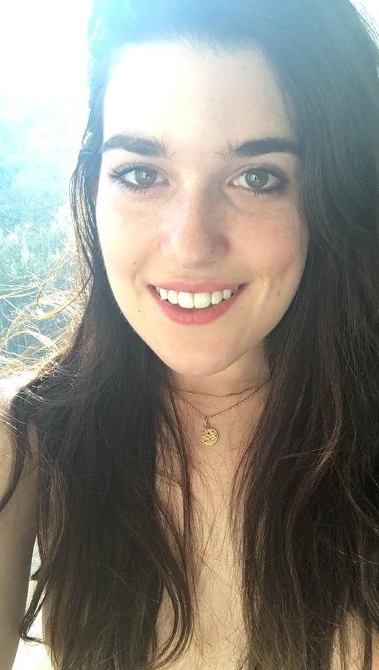 25P DNC operative with puffy Nipples