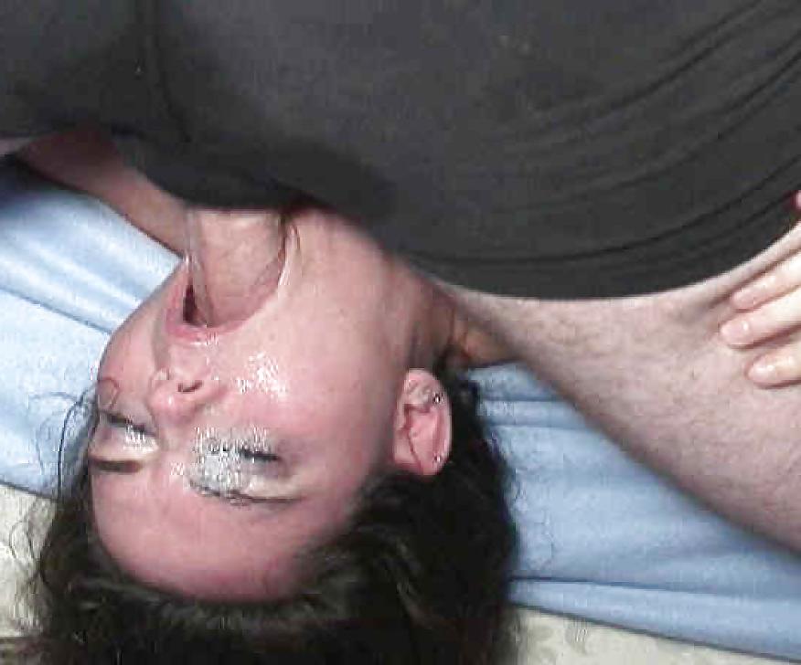20P Deep oral