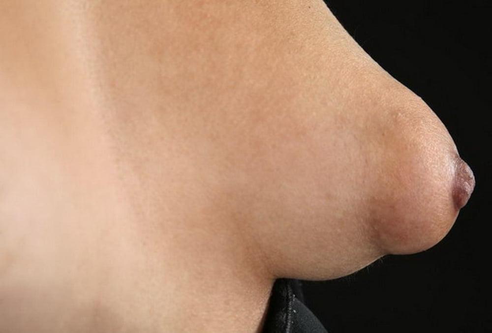 20P Puffy Nipples