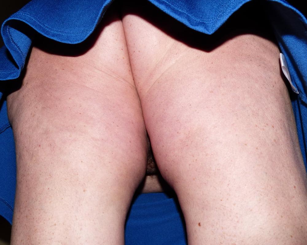7P upskirt