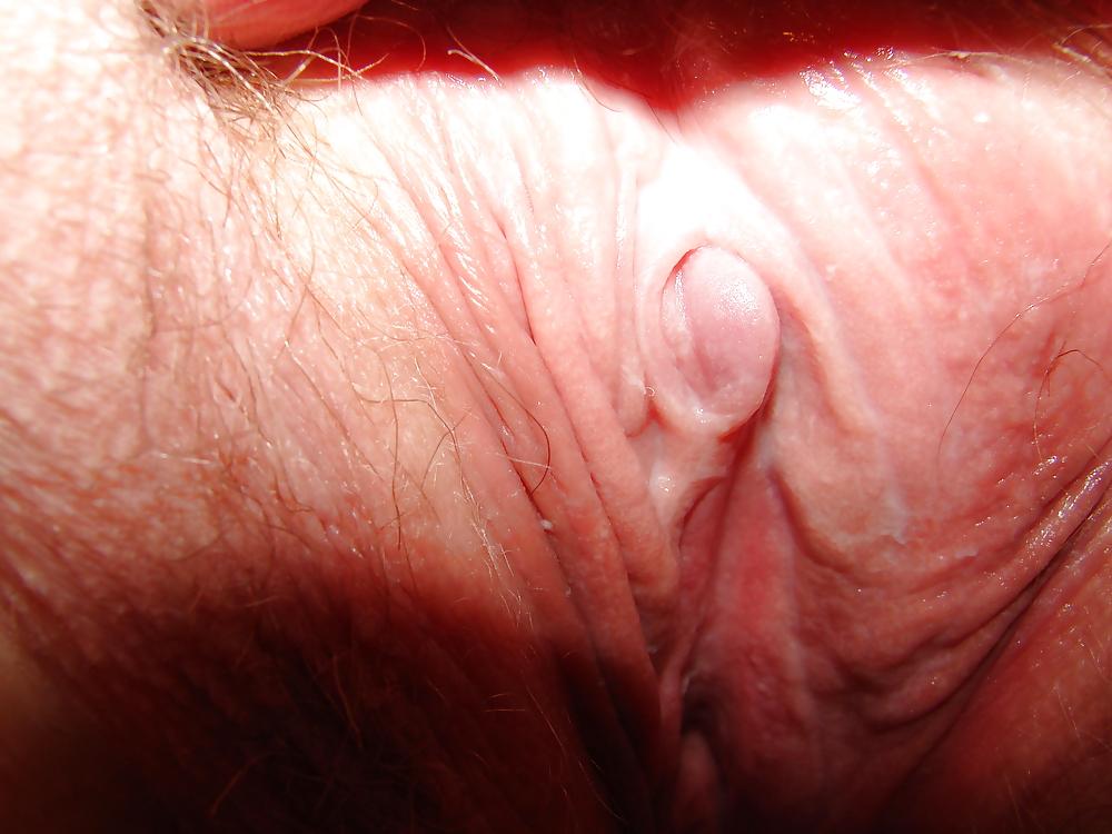 10P Her Clit