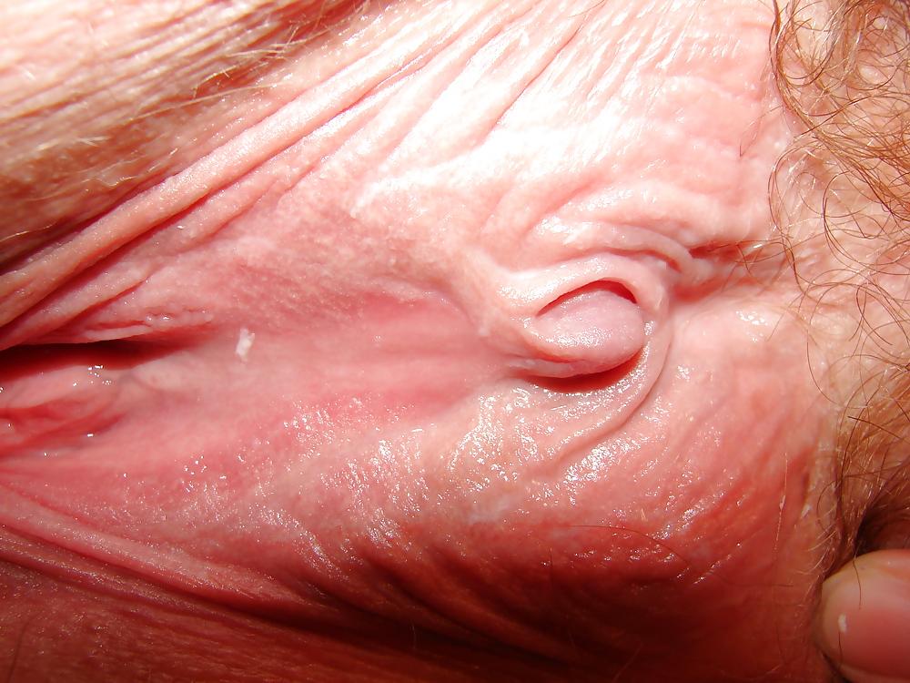 10P Her Clit