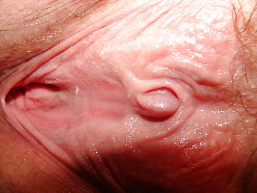 10P Her Clit