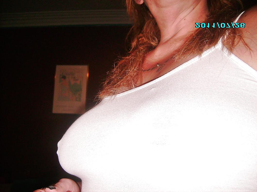 9P Nipples