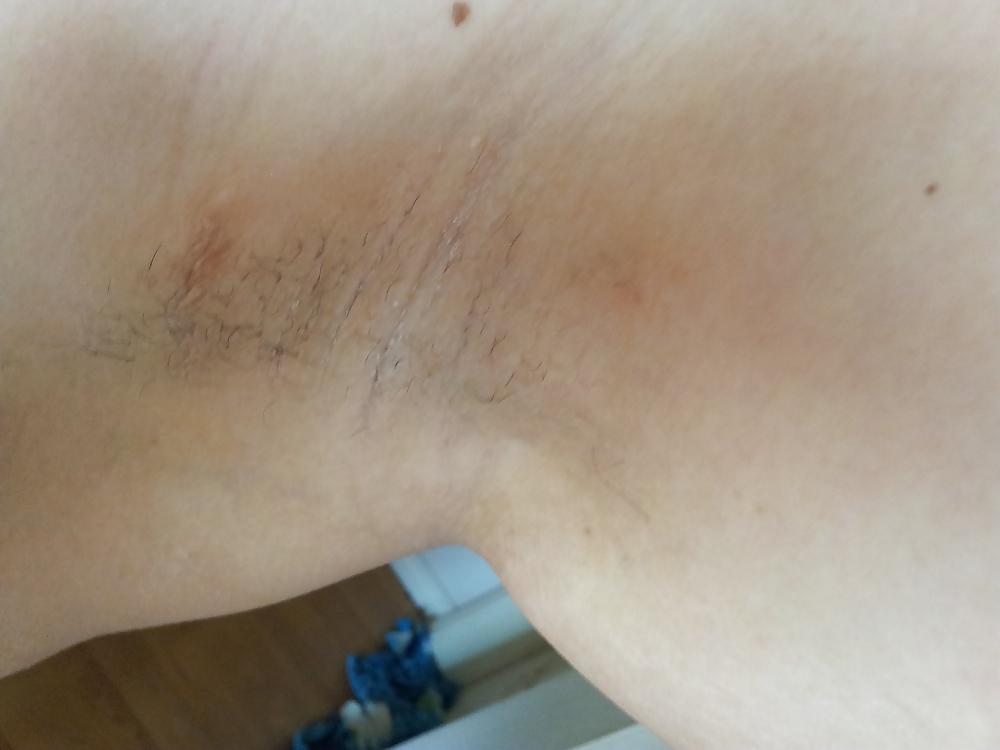 9P Nipples