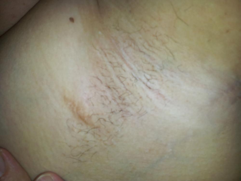 9P Nipples