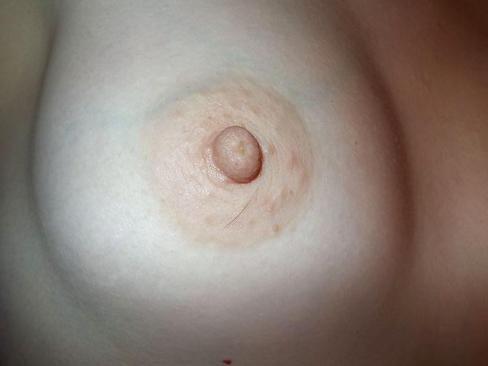 25P Nipples