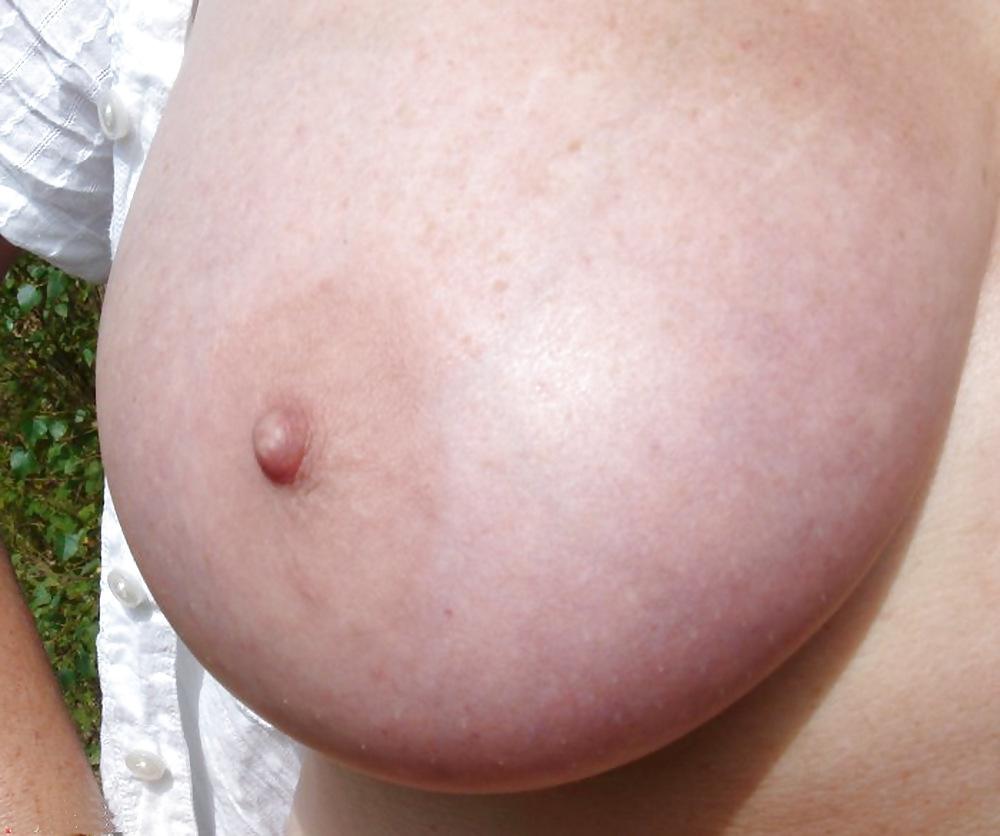 25P Nipples