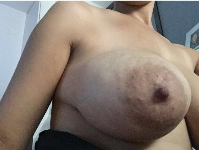 10P Breasts and nipples