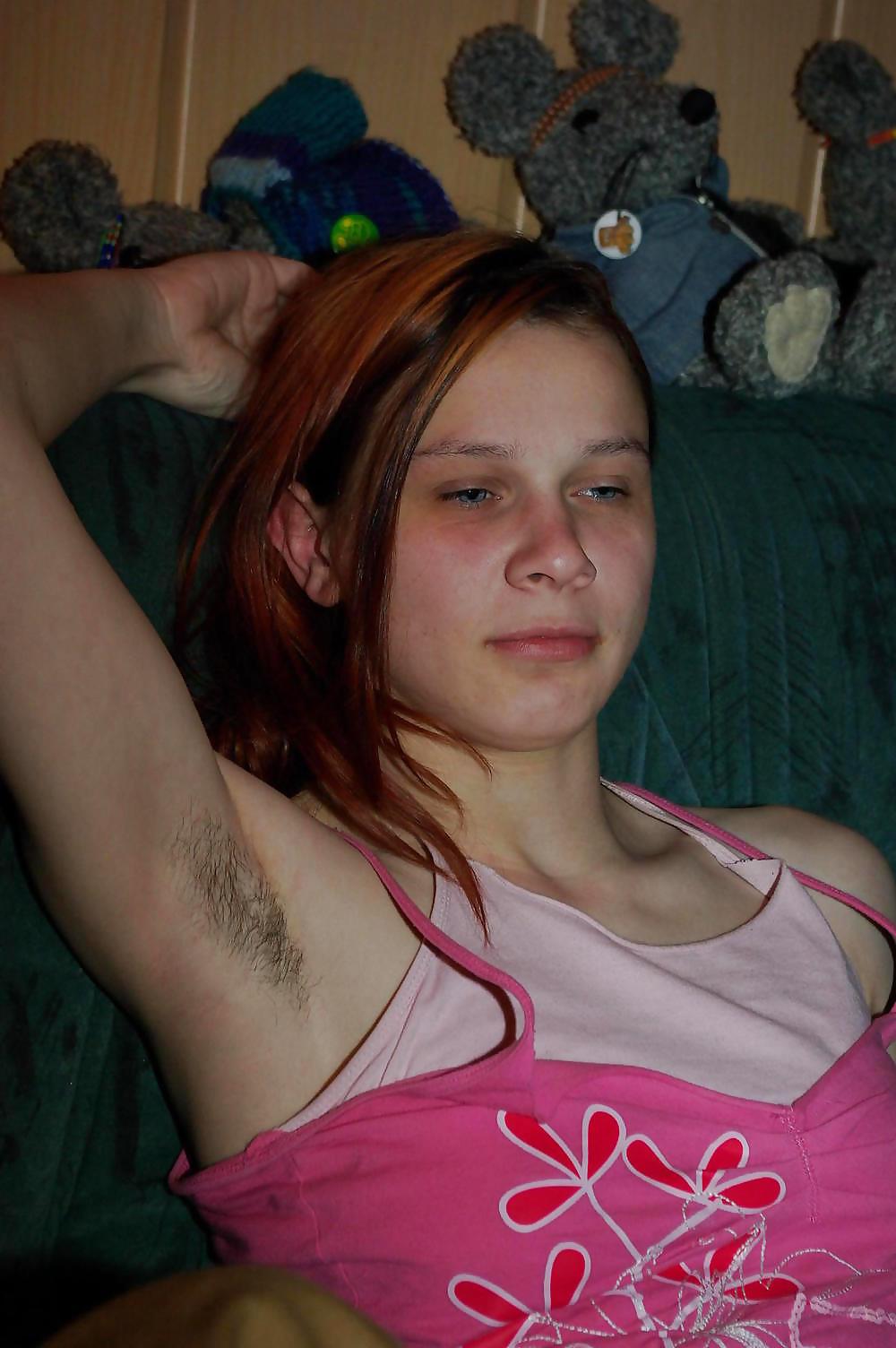 25P Armpits and nipples