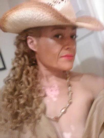 8P Skinny vitiligo granny