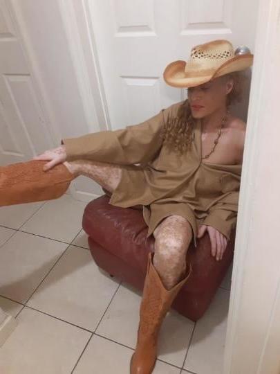 8P Skinny vitiligo granny