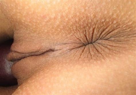 23P Close up assholes
