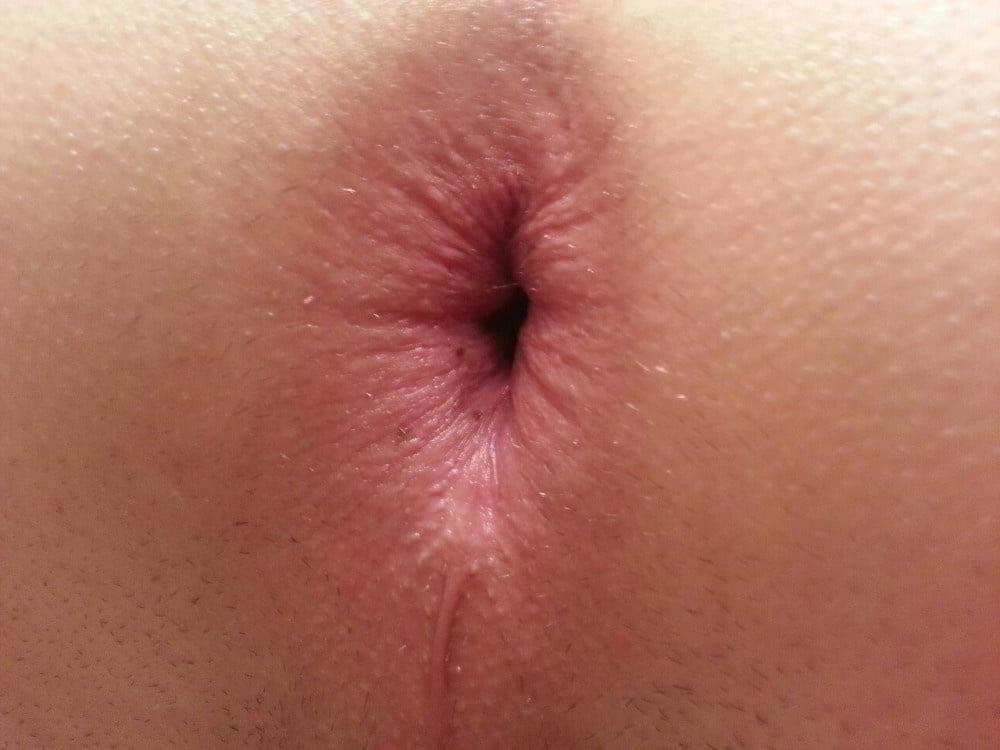 23P Close up assholes
