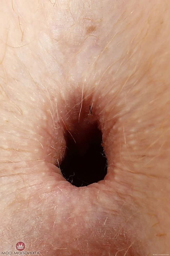 23P Close up assholes