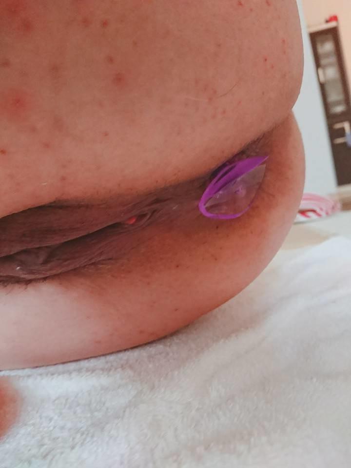 8P Anal-Syame