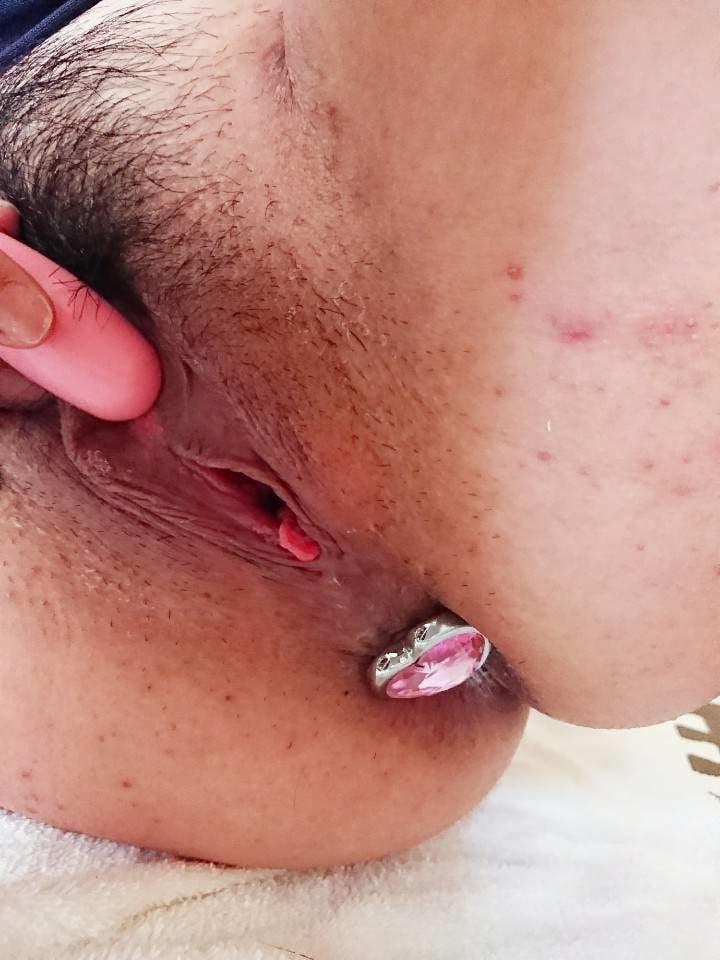 8P Anal-Syame