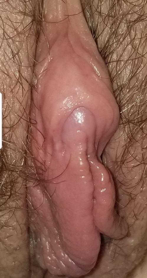 25P Nipples star with hairy bitches, clits, asses and more!