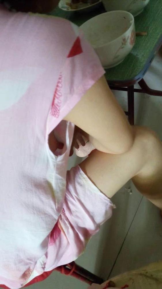 13P Puffies and Nipples